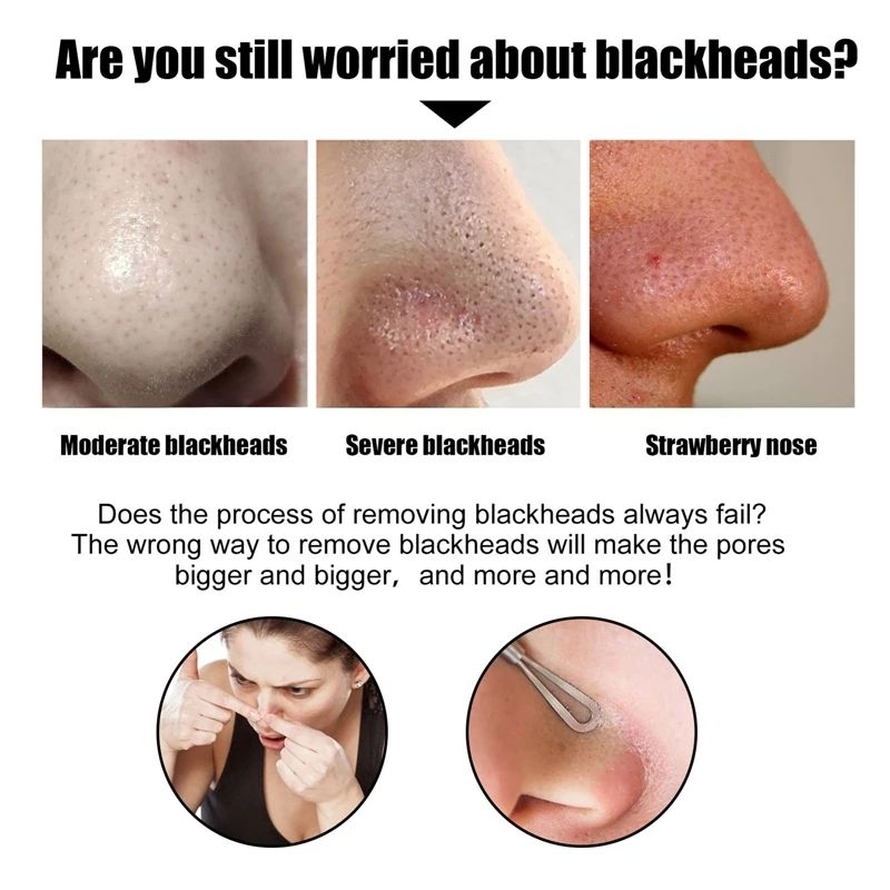 🖤Charcoal Nose Strips 6PCS | Deep Cleansing Blackhead Remover Pore Strips✨