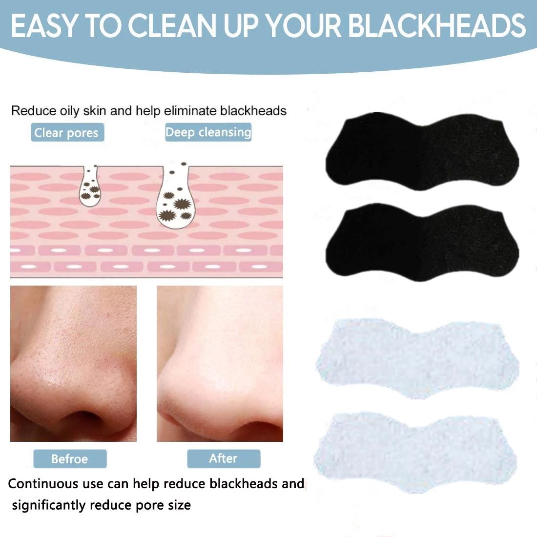 🖤Charcoal Nose Strips 6PCS | Deep Cleansing Blackhead Remover Pore Strips✨